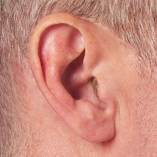 Completely-In-Canal Hearing Aid in ear
